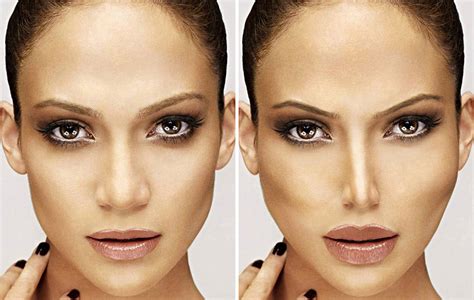 10 Celebrities Faces Before And After Surgery Celebrity