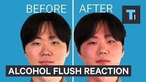 alcohol flush reaction public health