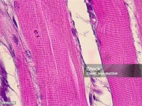 Jaringan Otot Luris Luris Gambar Mikroskopis Foto Stok Unduh Gambar