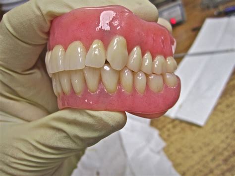 dentures temporary dentures portland beaverton gresham oregon