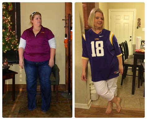 August Member Spotlight Weight Loss Surgery Before And After Obesityhelp
