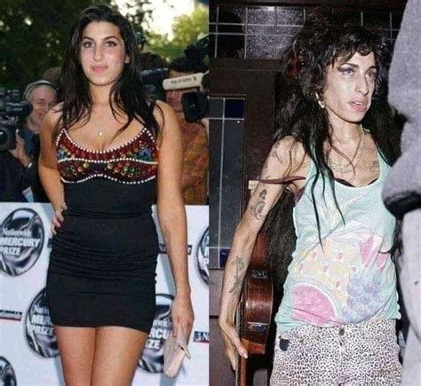 Amy Winehouse Sus Impactantes Fotos Antes Y Después De Su Adicción Al