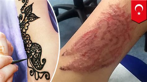 henna tattoo scars best tattoo design