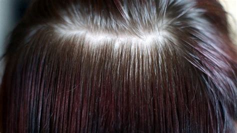 simple ways  check   hair loss   normal limits lifehacker australia