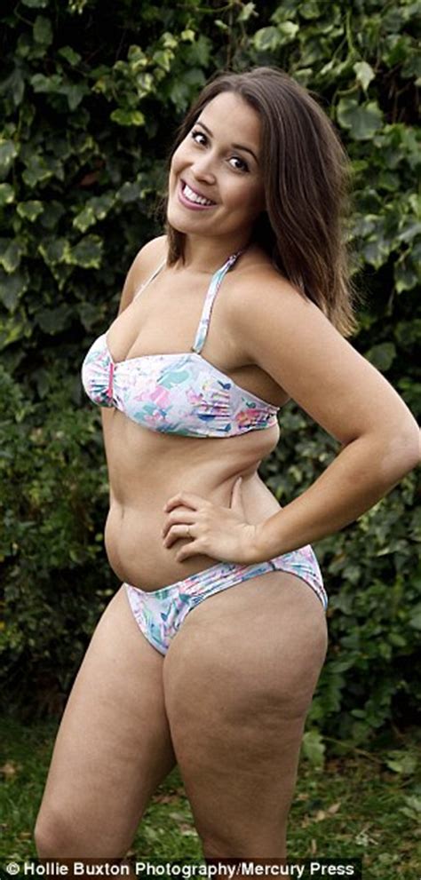 Former Anorexic Megan Jayne Now Shares Bikini Pictures Of Herself