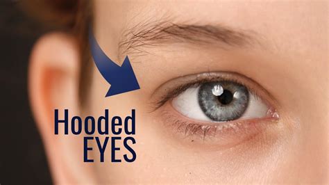 hooded eyes   correct answers barkmanoilcom