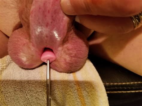 Sounding My Subincision 2 Pics Xhamster