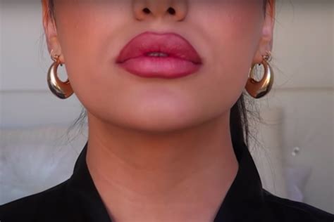 tieners proberen massaal deze bizarre trend voor vollere lippen