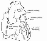 Coronary Arteries Anatomy Artery Diagonal Angiogram Angioplasty Stent Pci Circulation Veins Darah Medication Insertion Discharge Aliran Nhs Number Clipartxtras Artigo sketch template