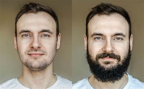 reasons    grow  beard  growth tips bald beards