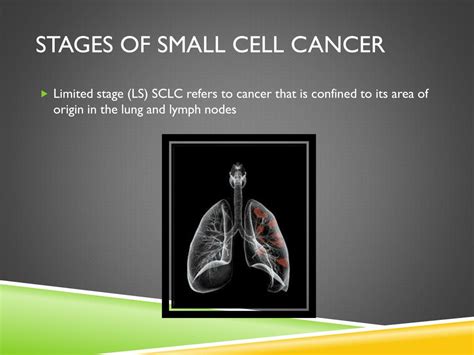 Ppt Lung Cancer Powerpoint Presentation Free Download Id 2117881