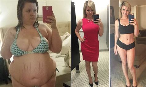 Obese Woman Who Binged On Carbs And Sugary Snacks Lost An