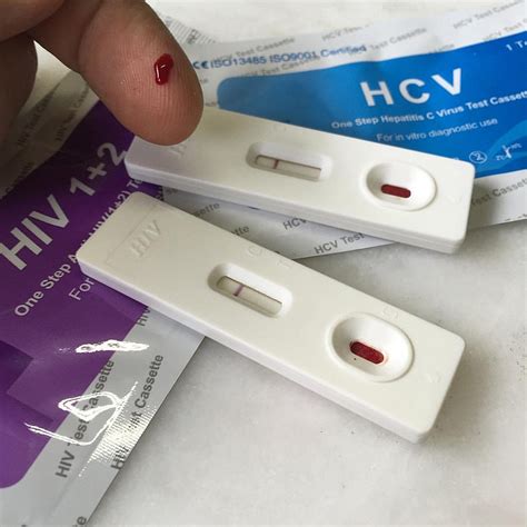 lab tests  hiv rapid test cd count viral load