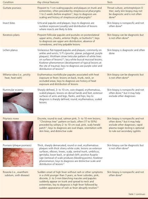 table    generalized rash part  differential diagnosis