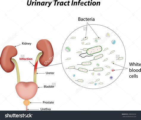 Urinary Clipart Clipground