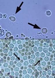 microscopic urinalysis