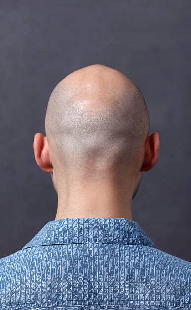 Royalty Free Bald Head Back Pictures Images And Stock