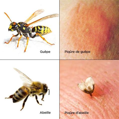 comment distinguer les differentes piqures dinsectes piqure insecte piqure de guepe abeille