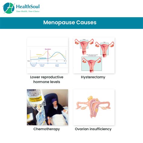 Menopause Symptoms Diagnosis And Treatment Healthsoul