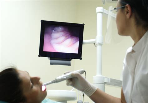 intraoral camera unique dental  worcester