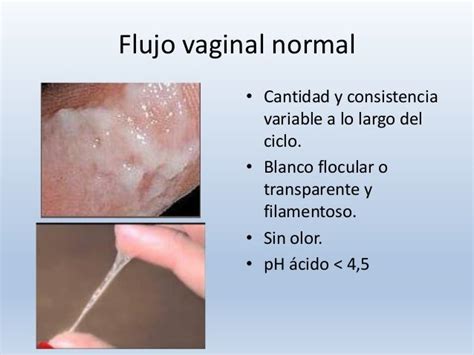 Vaginitis Farmacia Ulm San Fulgencio Alicante