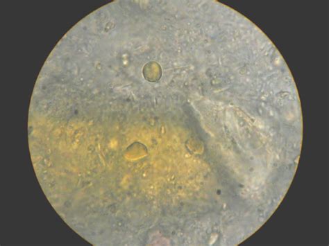 3 protozoa on curezone image gallery
