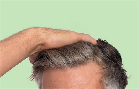 stages  hair loss  minutes  cornerstone