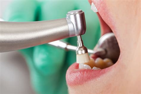professionelle zahnreinigung  hilft wem zahnarzt dr med dent