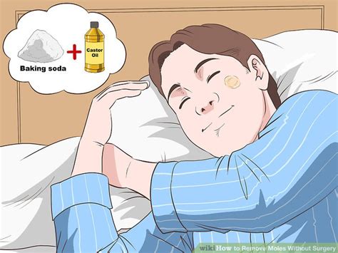 how to remove moles without surgery with pictures wikihow