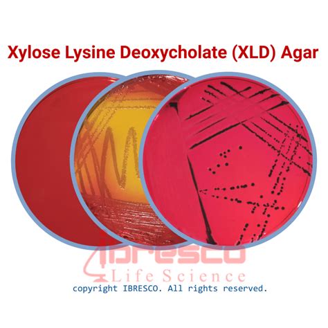 xylose lysine deoxycholate xld  ibresco