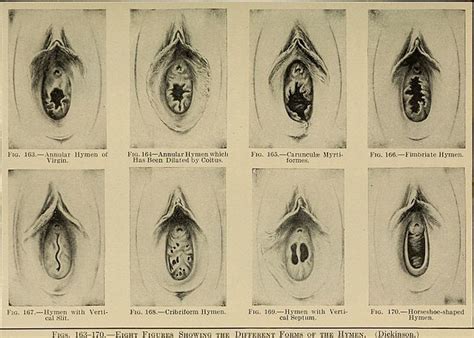 hymen intact