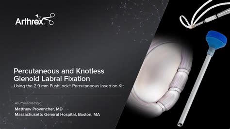 Arthrex Percutaneous And Knotless Glenoid Labral Fixation Using The 2