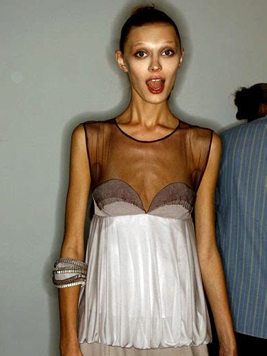 Funny Image Clip Anorexic Girls Funny Picture And Funny