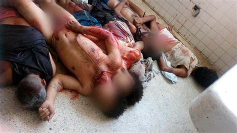 Las Dramáticas Fotos De La Masacre Del Régimen De Maduro En La Cárcel