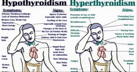 here is everything you should know about thyroid disorders signs