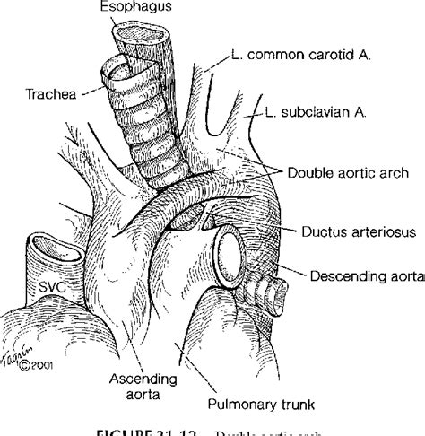 [pdf] Trachea Anatomy And Pathology Semantic Scholar