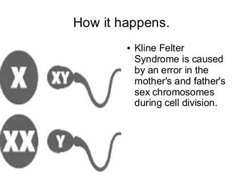 Klinefelter Syndrome Hrb