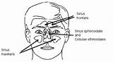 Sinuses Paranasal Skull Anatomy 1g sketch template
