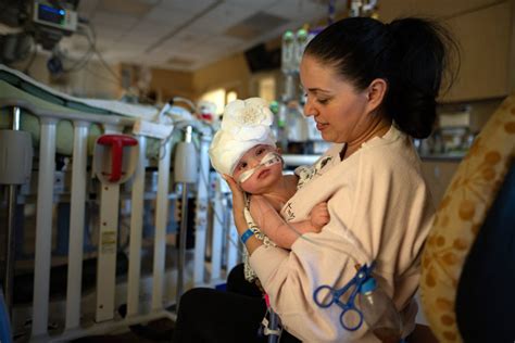 Rare Conjoined Twins Successfully Separated ‘it’s All In God’s Hands