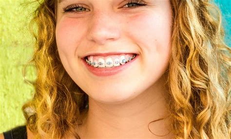 Girl With Braces – Telegraph