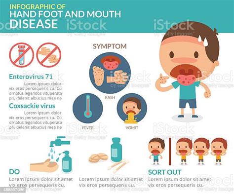 hand foot and mouth disease infographic stock illustration download