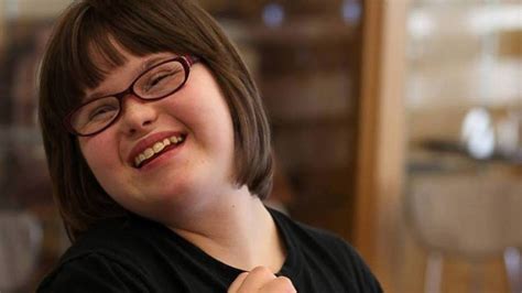 Modeling Dream Comes True For Girl With Down Syndrome