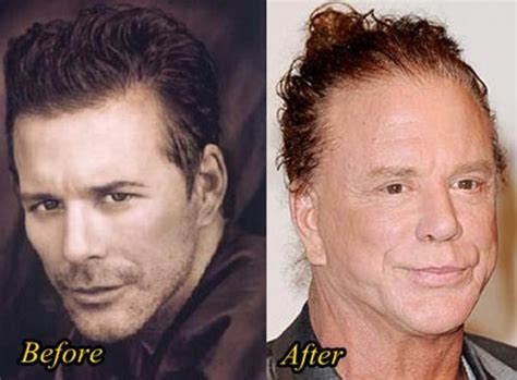 top 10 famous people who were victims of plastic surgery