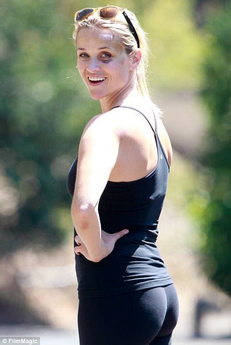 Reese Witherspoon Shrugs Off Her Injuries As She Takes Up
