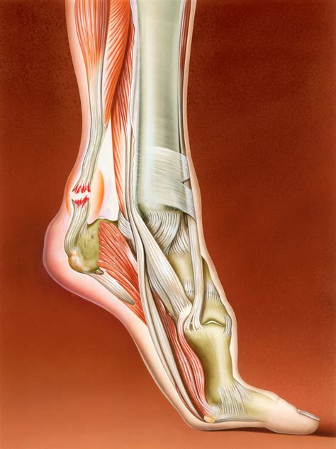 Why Kevin Durant S Achilles Tendon Was His Achilles Heel Wired