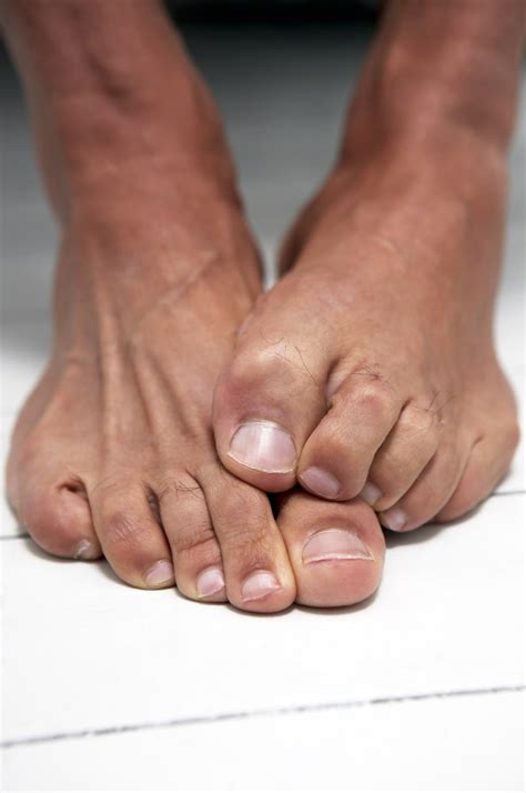 hairy toes fix your ugly feet men s journal