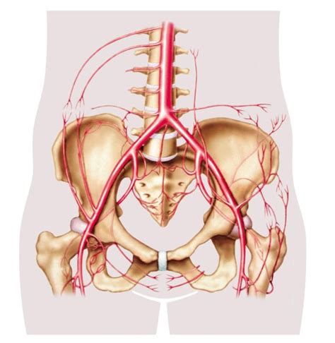 What Are The Signs And Symptoms Of Dissecting Iliac Artery Aneurysm
