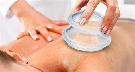 cupping therapy lada chrástná massages kinesio taping