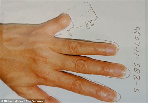 The Japanese Prosthetics Maker Who Reconstructs Fingers For Victims Of