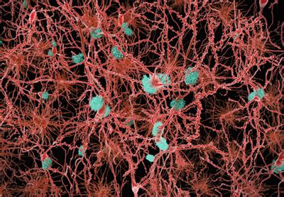 harnessing brains immune system clears amyloid plaques